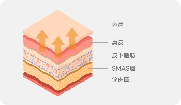 Traditional Facelift